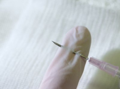 needlestick-injury.jpg