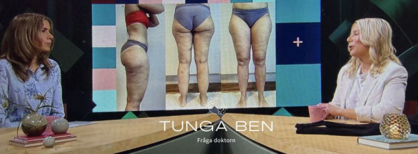 Dåligt lymfflöde ger tunga ben.