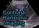 Contrast Harmonic Imaging