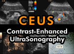Contrast-Enhanced UltraSonography of pa...