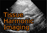 Tissue Harmonic Imaging