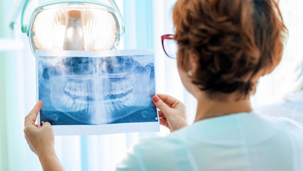 tandläkare undersöker röntgenbild