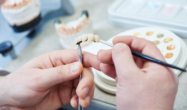 tandprotes – löständer